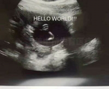 喜报!湖南张氏夫妇 实现儿女双全好梦!