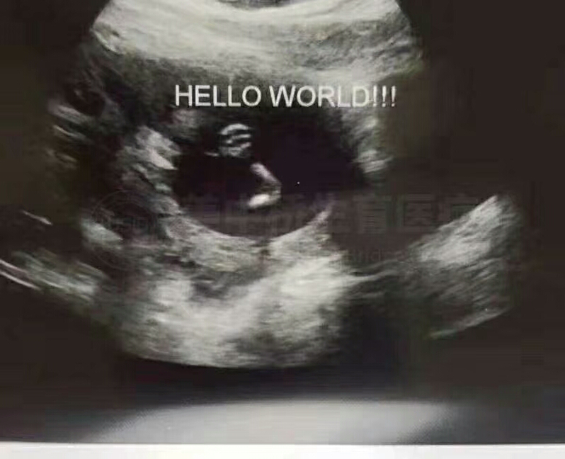喜报!湖南张氏夫妇 实现儿女双全好梦!